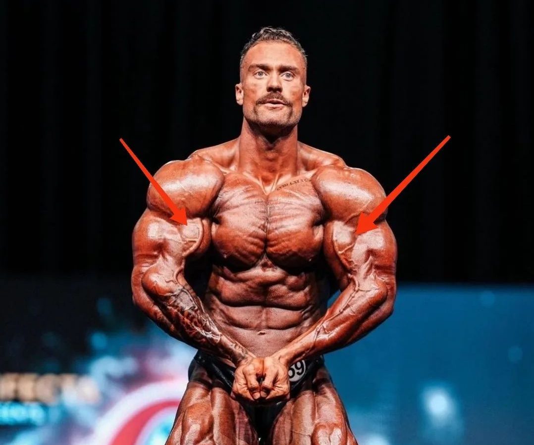 Chris Bumstead afirma ter competido Olympia com o bíceps rompido – Conheça os detalhes