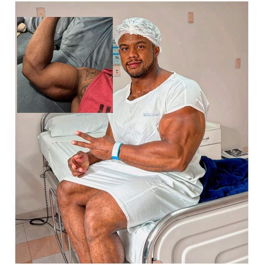 Livinho sofre lesão grave no bíceps e precisa recorrer a uma cirurgia