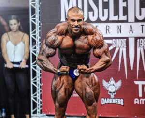 Marcelo Horse mostra evolução assustadora nas redes sociais após 4 meses