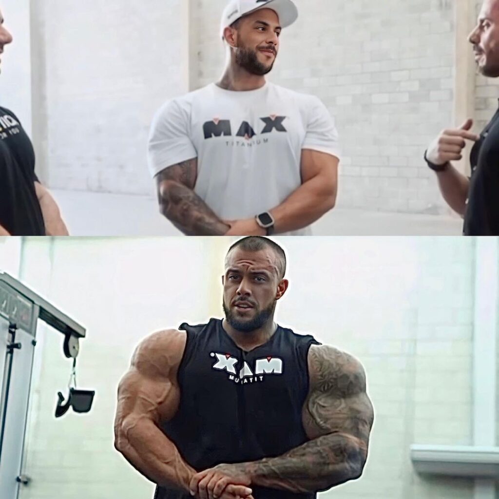 Marcelo Horse mostra evolu&ccedil;&atilde;o assustadora nas redes sociais ap&oacute;s 4 meses