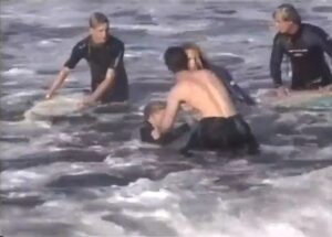 “Olhei para baixo e metade do meu braço estava pendurado por um fio”, relata surfista após ataque duplo de tubarões