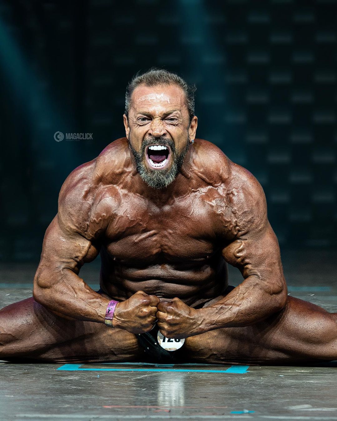 Fernando Sardinha expõe verdades sobre esteroides anabolizantes