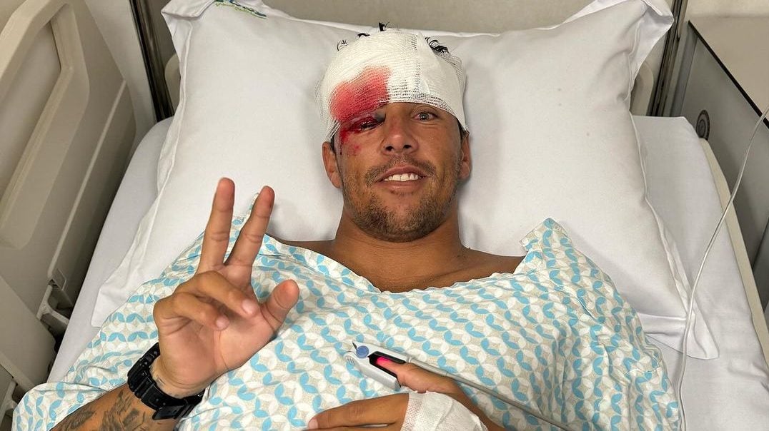 “Pensei que ia morrer”, surfista revela DRAMA após acidente