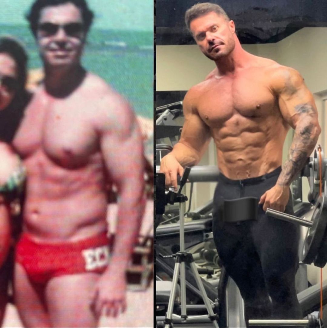 Antes e depois Renato Cariani