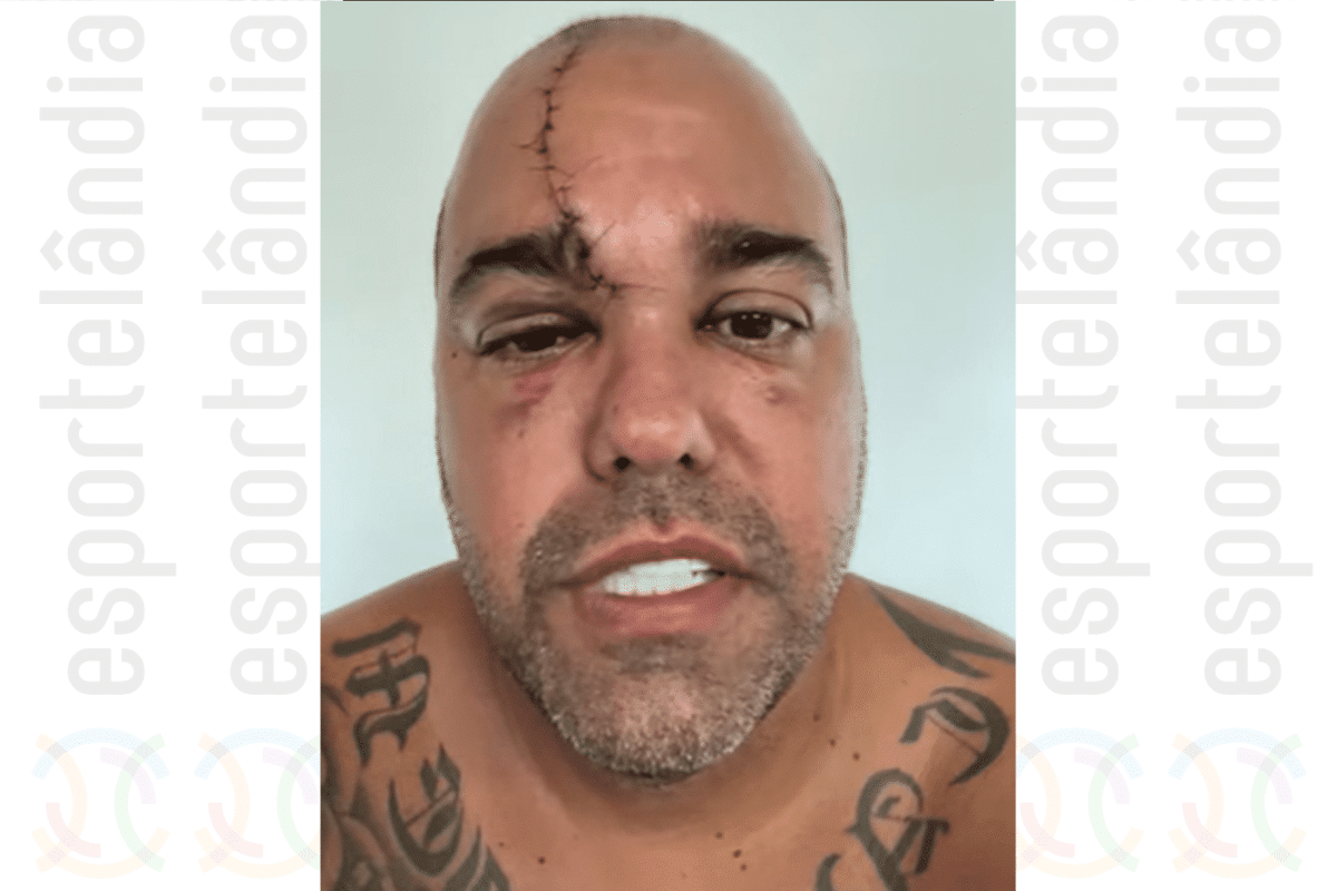 Bodyboarder sofre acidente gravíssimo e tem corte profundo na cabeça