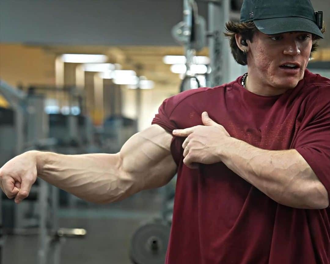 (VÍDEO) Sam Sulek, promessa do fisiculturismo, sofre lesão preocupante