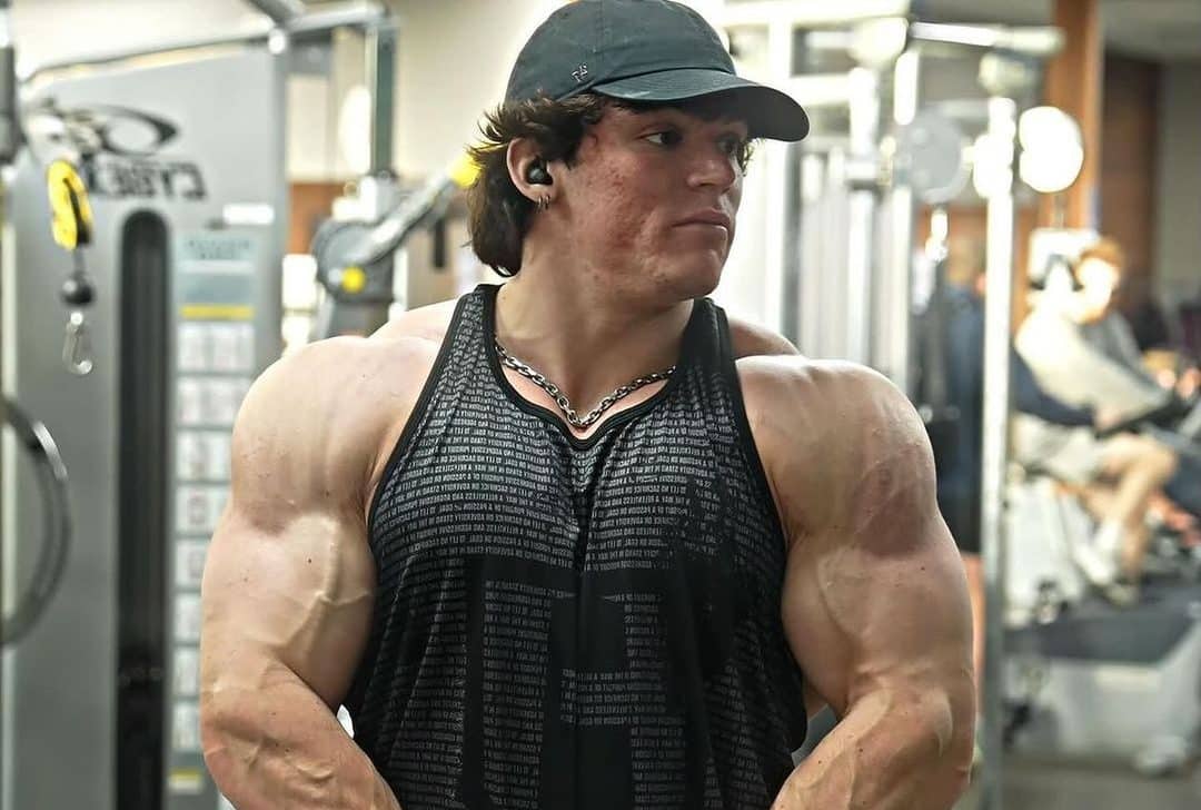 (VÍDEO) Sam Sulek, promessa do fisiculturismo, sofre lesão preocupante