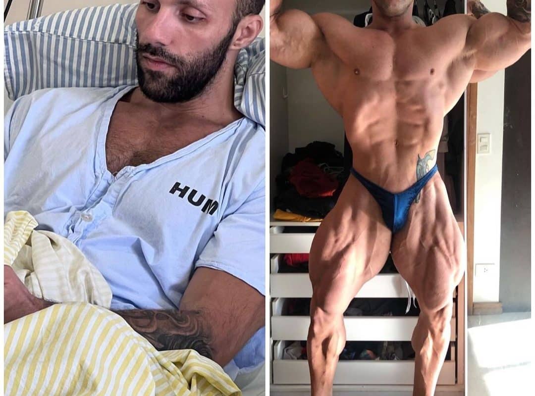 SUPERAÇÃO! Fisiculturista mostra evolução impressionante 1 mês após quase morte