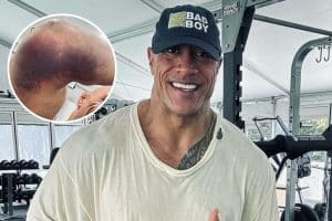 The Rock sofre grave lesão, entenda os detalhes