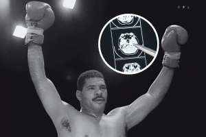 O que é a ETC, doença comum no boxe que causou a morte de Maguila?