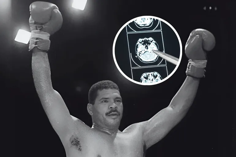 O que é a ETC, doença comum no boxe que causou a morte de Maguila?