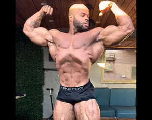 Quadro grave! Eduardo Edoc admite passar por problema de saúde